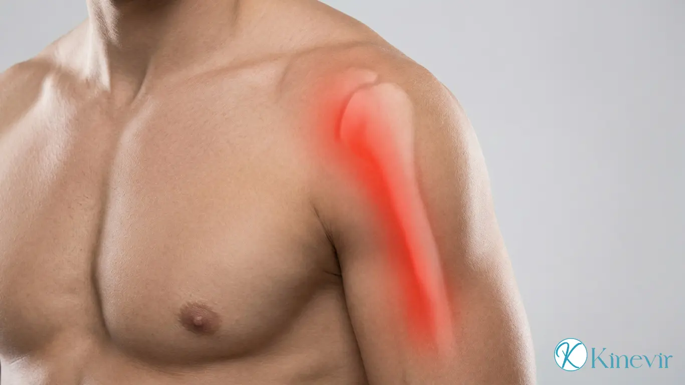 Douleur antérieure de l'épaule le long du tendon du biceps - tendinopathie du biceps