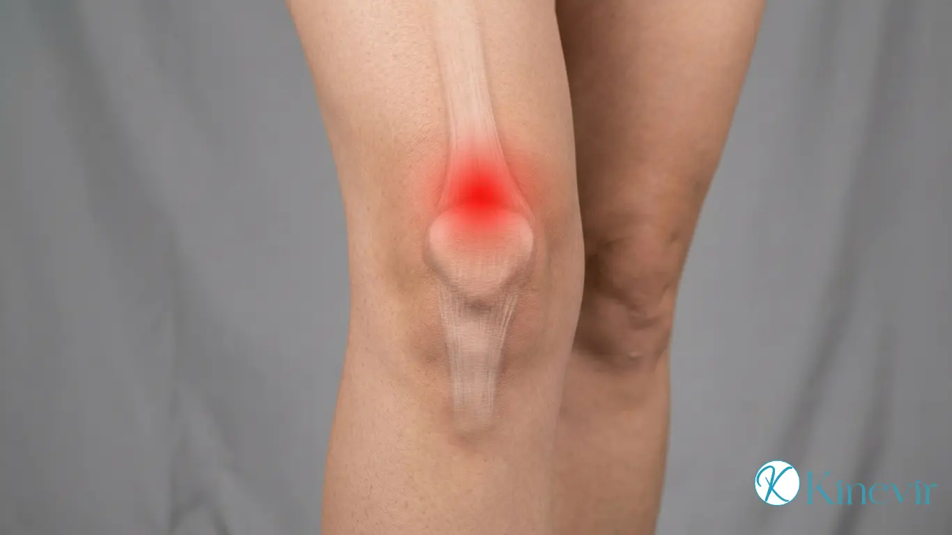 Douleur au-dessus de la rotule dans la tendinopathie quadricipitale